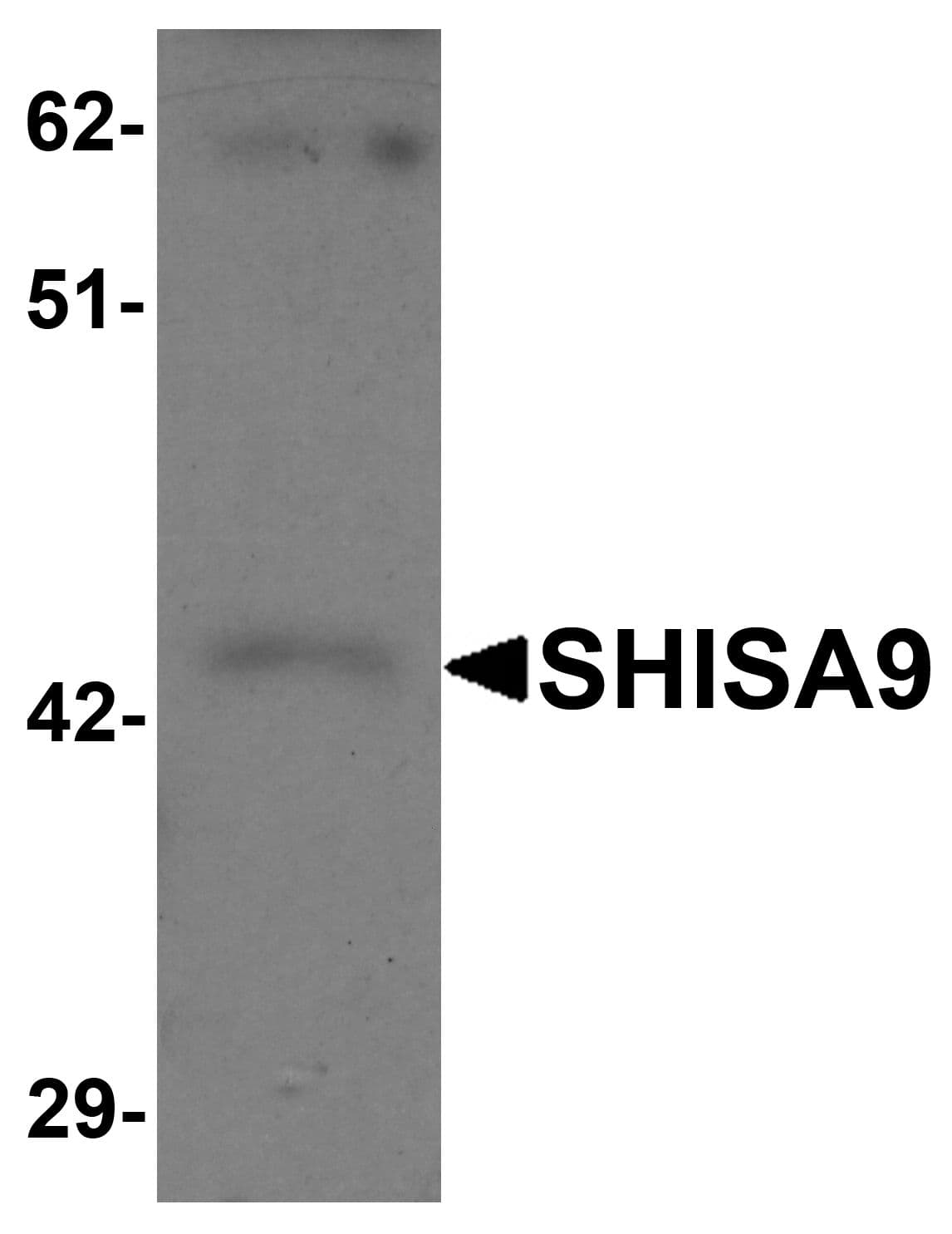 IHC-plus™ SHISA9 Antibody