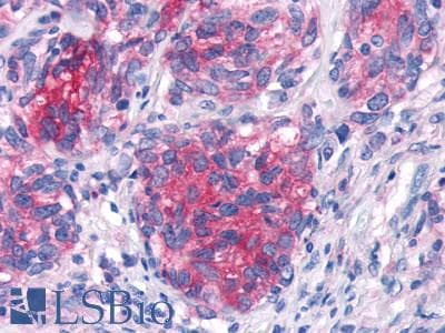 PathPlus™ GPR44 / CRTH2 Antibody (N-Terminus)