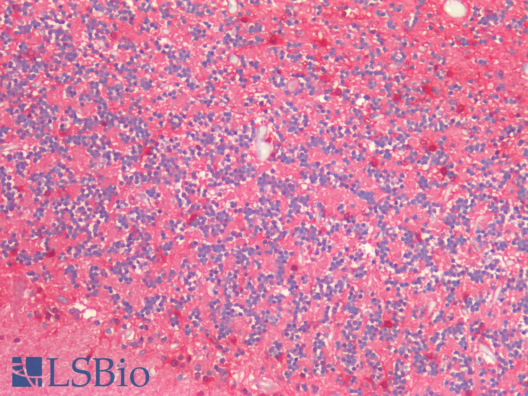 IHC-plus™ S100A1 / S100-A1 Antibody (Internal)
