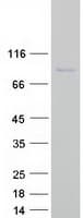 Human CENPT Protein (Recombinant Myc-DDK (Flag))