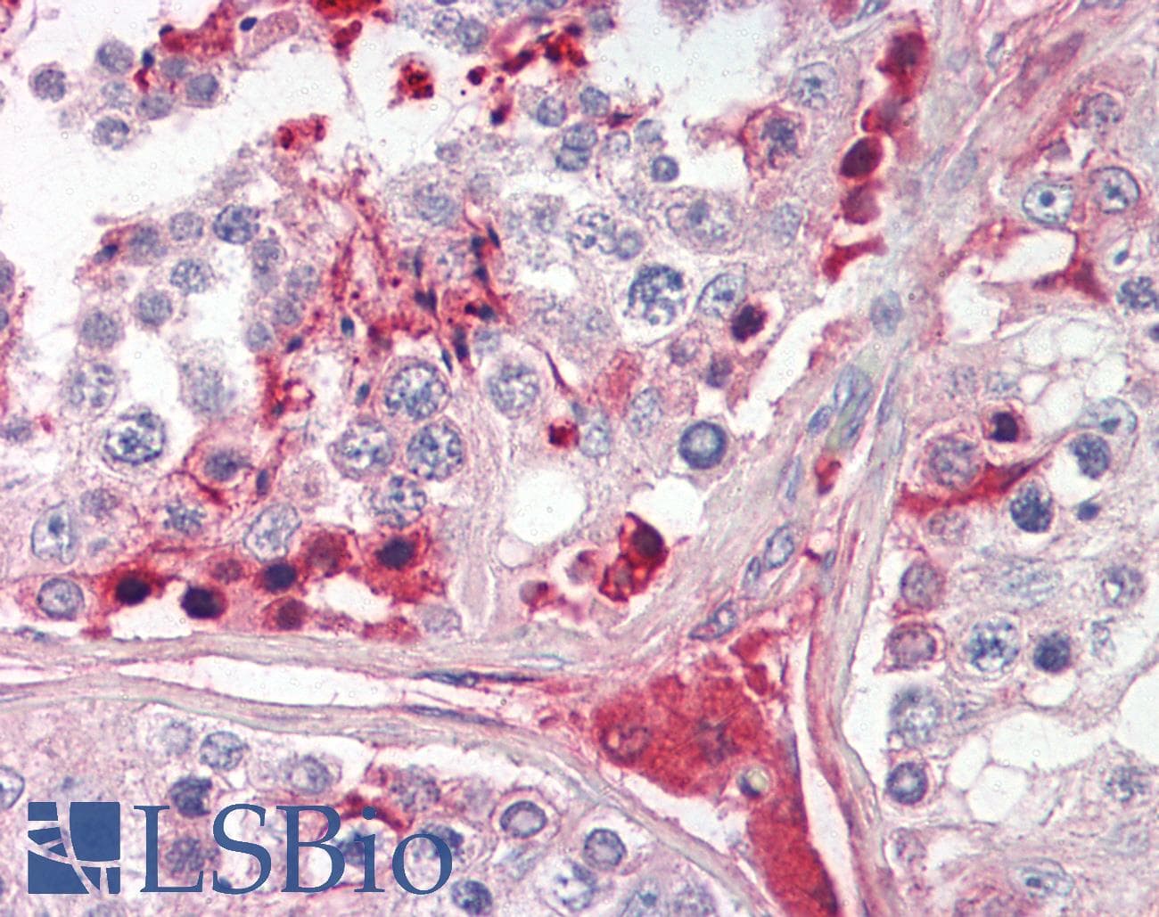 IHC-plus™ Polyclonal Goat anti-Human CRISP2 / TSP1 Antibody (aa81-93, IHC, WB)