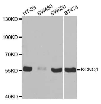 KCNQ1 / KVLQT1 Antibody