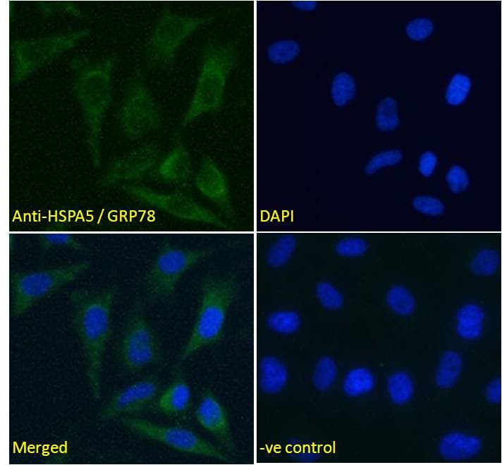 IHC-plus™ HSPA5 / GRP78 / BiP Antibody