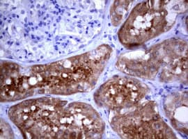 PIK3C2A Antibody (aa230-560, clone OTI1B8)