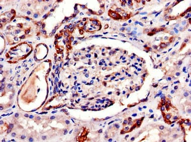 AQP6 / Aquaporin 6 Antibody