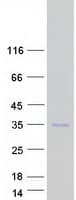 Human RAB12 Protein (Recombinant Myc-DDK (Flag))