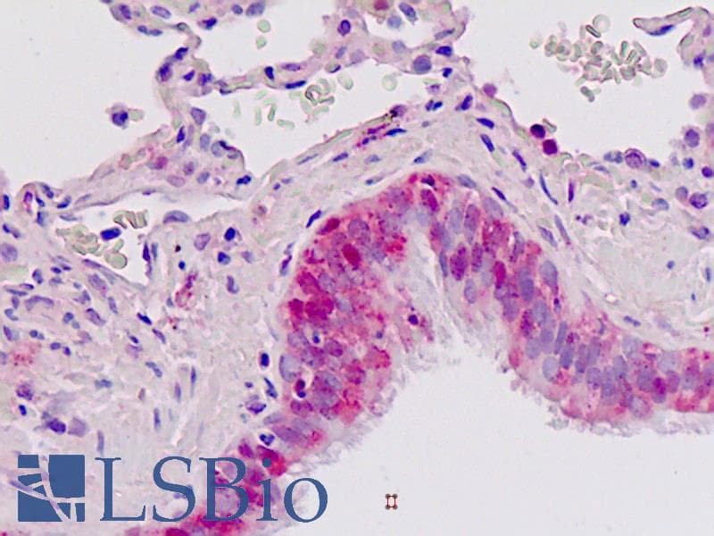 IHC-plus™ IGFBP2 / IGF-BP53 Antibody (aa277-305)
