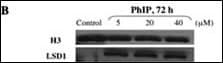 Polyclonal Rabbit anti-Human KDM1A / LSD1 Antibody (aa819-852, IHC, IF, WB)