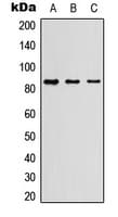MPO / Myeloperoxidase Antibody (Internal)