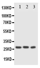 FADD Antibody (aa174-189)