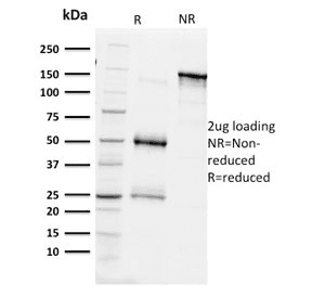Monoclonal Mouse anti-Human BAP1 Antibody (clone BAP1/2431, Azide-free,BSA-free, IHC)