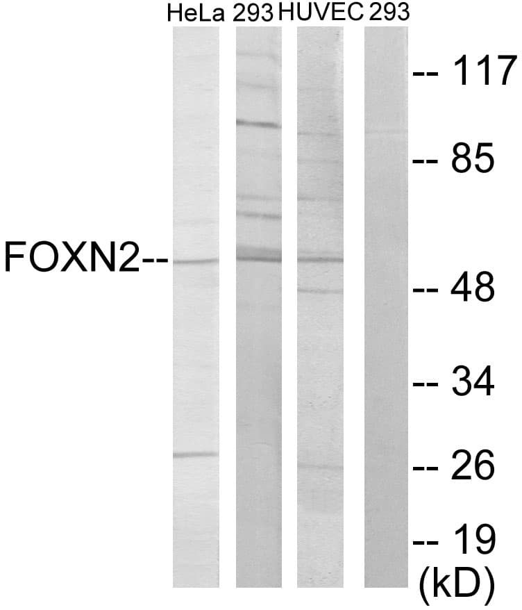 Polyclonal Rabbit anti-Human FOXN2 Antibody (aa341-390, WB)