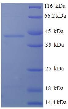 Human DGUOK / Deoxyguanosine Kinase Protein (Recombinant His-SUMO)