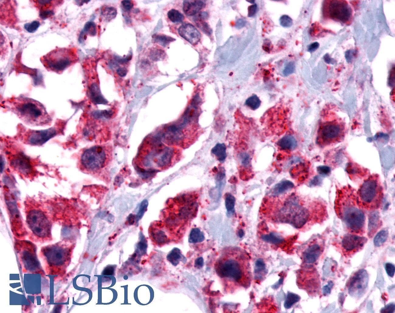 PathPlus™ GPCR6 / GPR101 Antibody (Cytoplasmic Domain)