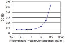 MIB1 Antibody (clone 3E10)