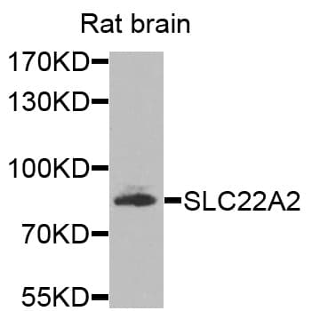 IHC-plus™ Polyclonal Rabbit anti-Human SLC22A2 Antibody (IHC, WB)