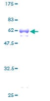 Human TGIF1 Protein (Recombinant GST)