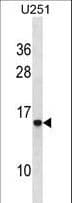 Polyclonal Rabbit anti-Human HPSE / Heparanase Antibody (aa26-54, WB)