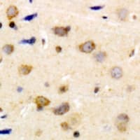Polyclonal Rabbit anti-Human CALD1 / Caldesmon Antibody (C-Terminus, IHC, IF, WB)