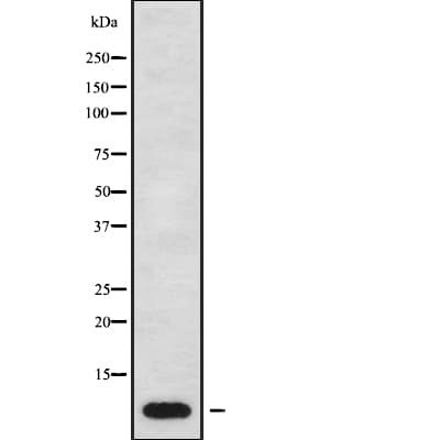 ATP5E Antibody