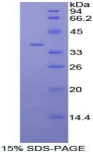 Human AKT3 Protein (Recombinant His-T7)