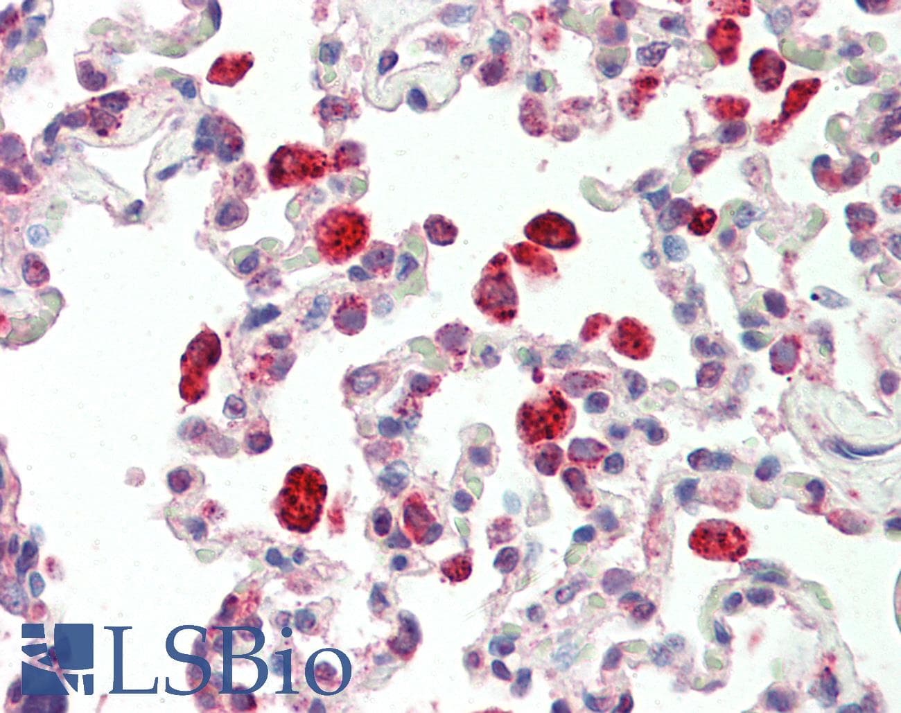 IHC-plus™ CTSC / Cathepsin C / JP Antibody (aa238-252)