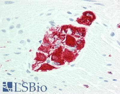 PathPlus™ Polyclonal Rabbit anti-Human Peripherin Antibody (Internal, IHC, WB)