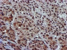GSTT2 Antibody (clone OTI3B6)