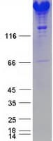 Human SPTAN1 / Alpha Fodrin Protein (Recombinant Myc-DDK (Flag))