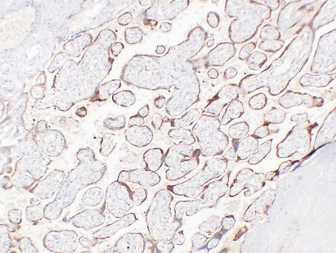 CGB / hCG Beta Antibody (clone ABT-HCGβ)