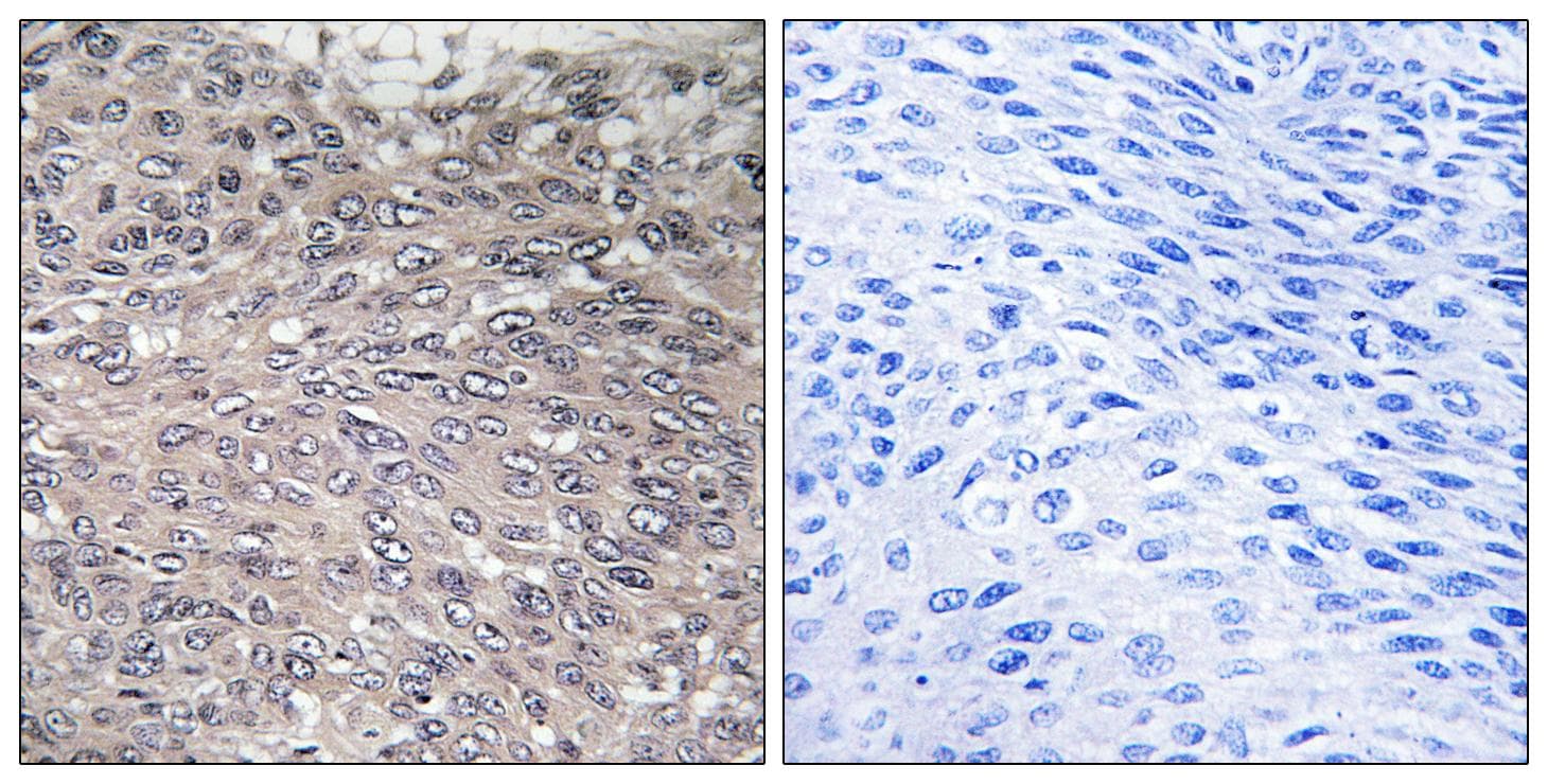 ITPR1 / IP3 Receptor Type 1 Antibody (phospho-Ser1598/1588)