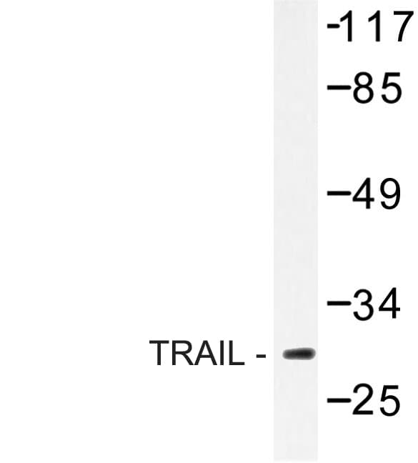 Polyclonal Rabbit anti-Human TNFSF10 / TRAIL Antibody (Ser63, IHC, IF, WB)