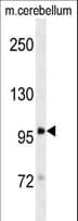 Monoclonal Mouse anti-Rat DLG4 / PSD95 Antibody (aa677-706, IHC, WB)