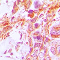 CASP8 / Caspase 8 Antibody (Internal)