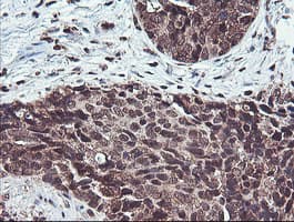 COPS5 / JAB1 Antibody (clone OTI2B12)