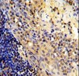 CD8A / CD8 Alpha Antibody (aa59-88)
