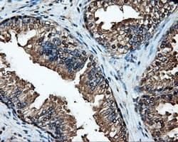 Heat Shock Protein 70 / HSPA1A Antibody (clone OTI1B2)