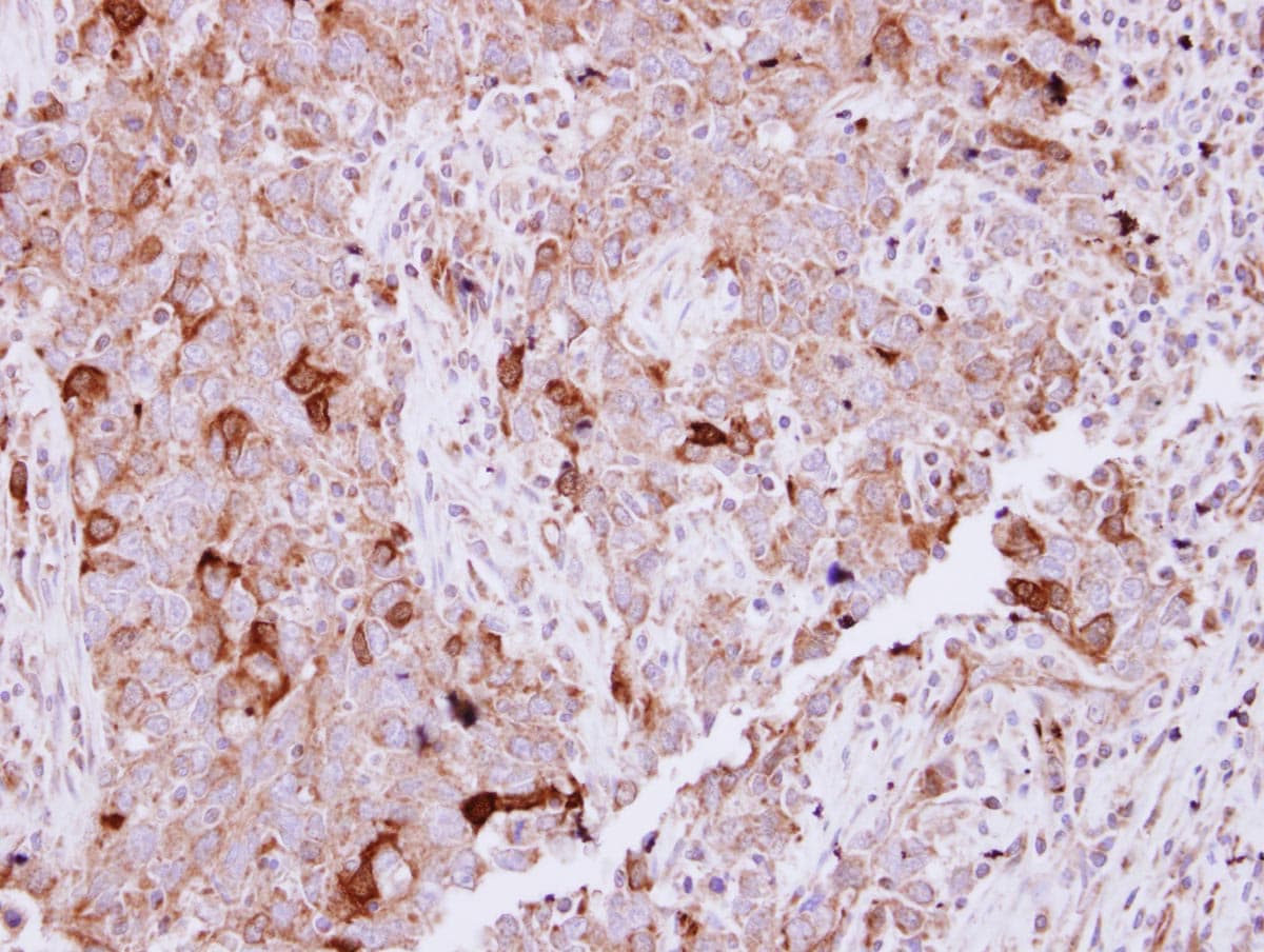 Polyclonal Rabbit anti-Human NCKAP1 / NAP125 Antibody (N-Terminus, IHC, WB)