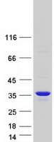 Human KCNRG Protein (Recombinant Myc-DDK (Flag))