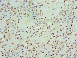 CAMK1G / CaMKI gamma Antibody (aa217-476)