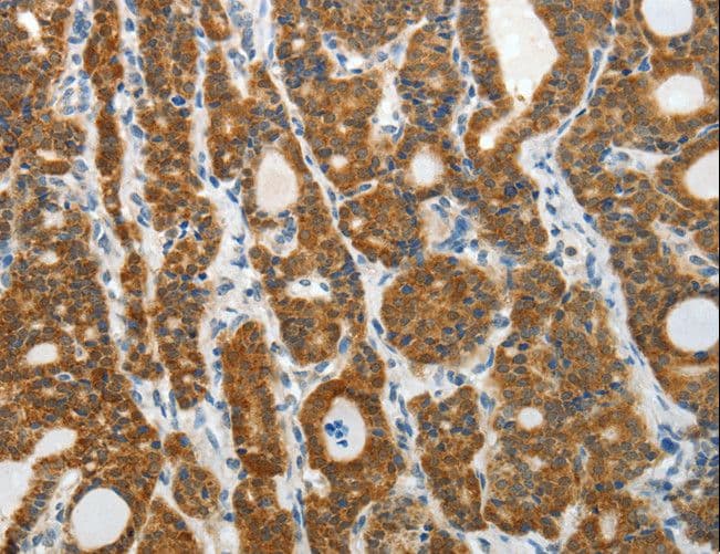 PRDX5 / Peroxiredoxin 5 Antibody