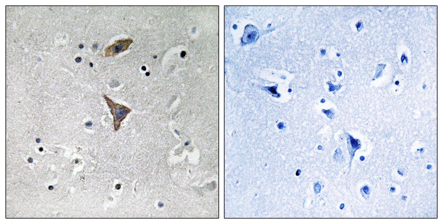 KCNT1 / KCa4.1 Antibody