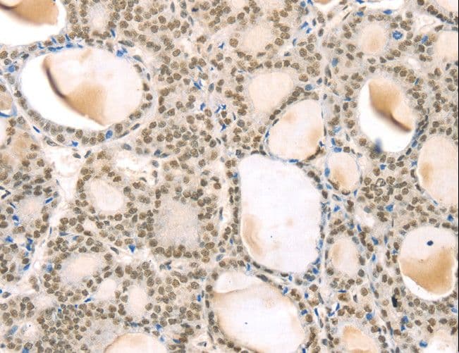 TSPAN13 / TM4SF13 Antibody