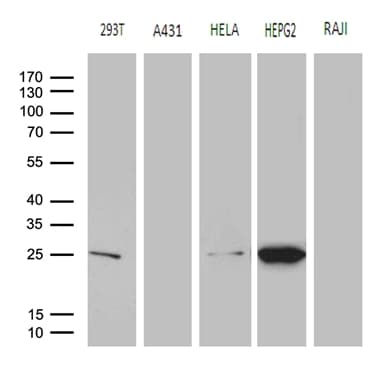 GSTZ1 Antibody (clone OTI6A10)