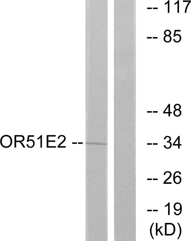 OR51E2 / PSGR Antibody (aa221-270)