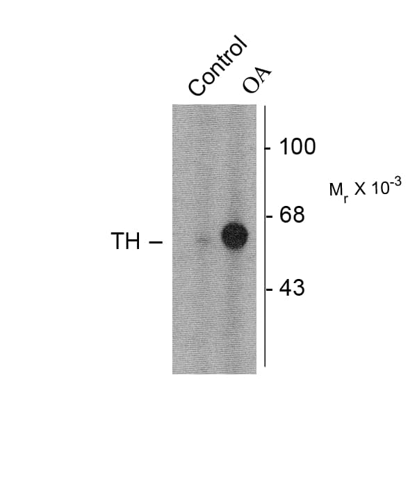 Polyclonal Rabbit anti-Rat TH / Tyrosine Hydroxylase Antibody (phospho-Ser31, IHC, IF, WB)