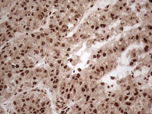 IRS1 Antibody (aa1-280, clone OTI3G10)
