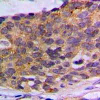 PLA2G4A Antibody (Internal)