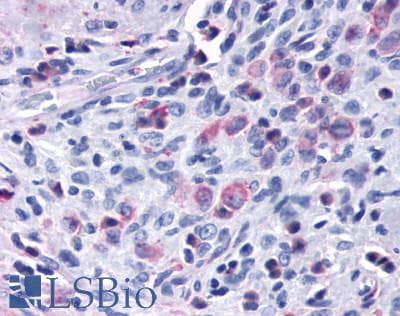 PathPlus™ Polyclonal Rabbit anti-Human CCR7 Antibody (Extracellular Domain, IHC)