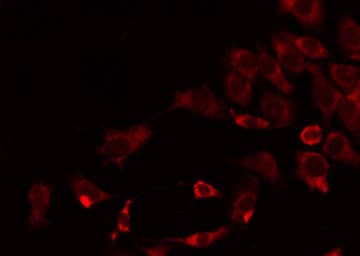 Polyclonal Rabbit anti-Human COX17 Antibody (IHC, IF, WB)
